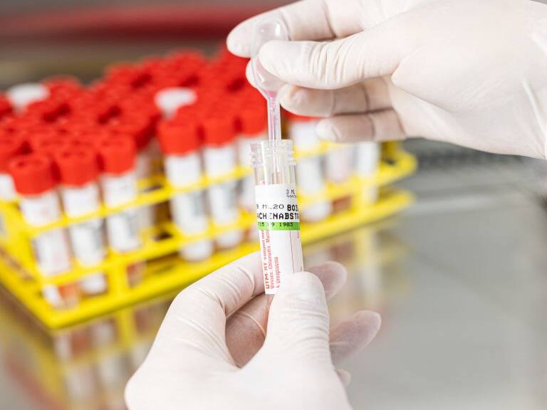 Viruela del mono: confirman primer caso en la región de Magallanes