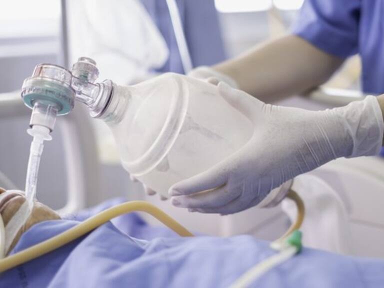 doctor holding oxygen ambu bag over patient given oxygen to patient by intubation tube in ICU/Emergency room