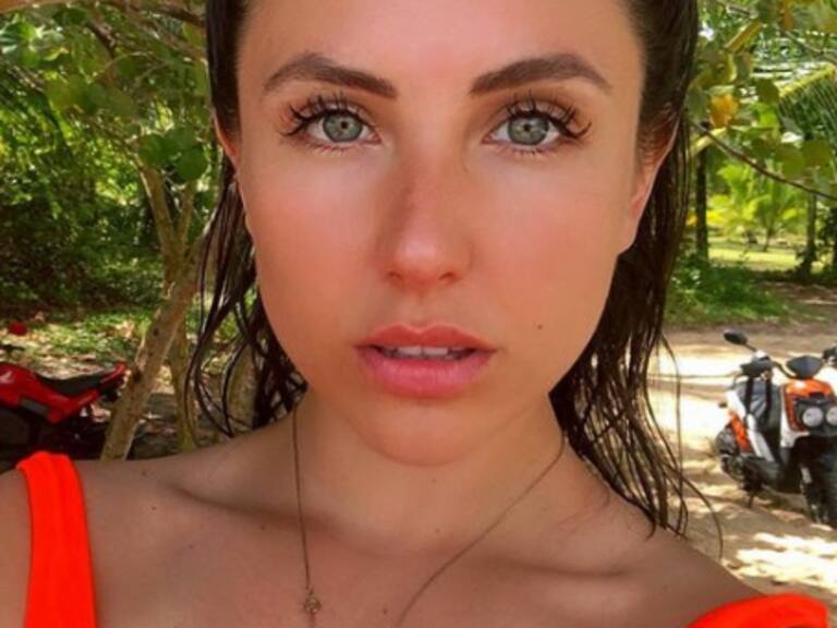 «Siguen chuecas»: Ángela Duarte sorprendió en Instagram al mostrar la forma de sus manos