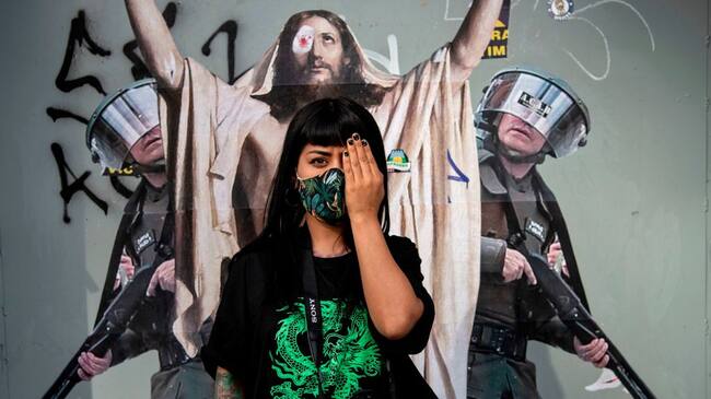 La fotógrafa Nicole Kramm posa con so ojo tapado por la violencia contra los medios independientes en Chile