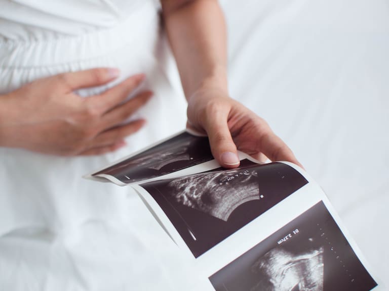Mujer nacida con dos úteros está embarazada en ambos: caso es tan raro que casi no existen verdaderos especialistas