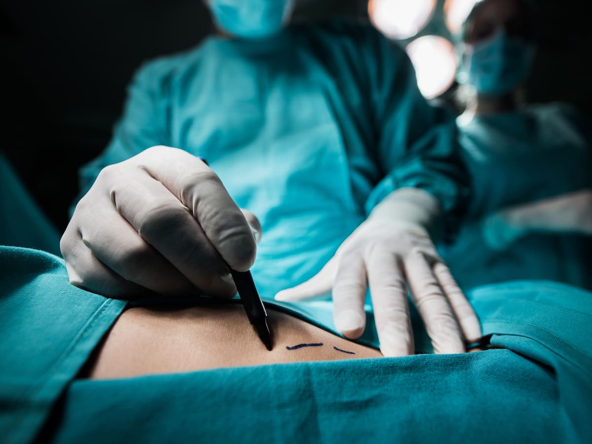Ante la muerte de mujer en clínica estética: cómo revisar si el médico que te opera está certificado en Chile
