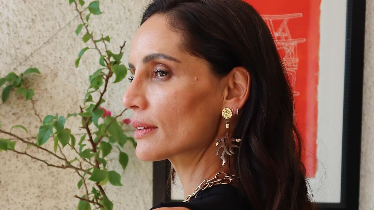 Leonor Varela sufre triple fractura durante vacaciones en México