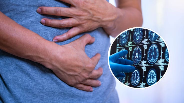 Estaría vinculado al Alzheimer: el común síntoma gastrointestinal que está relacionado a la enfermedad, según estudio