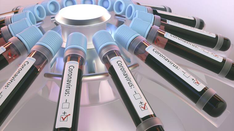 Coronaviruses research, conceptual illustration. Vials of blood in a centrifuge being tested for coronavirus infection.