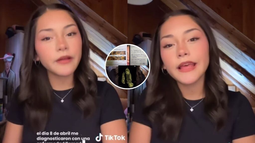 Joven chilena de 17 años pide ayuda urgente: necesita $50 millones para cirugía en el extranjero