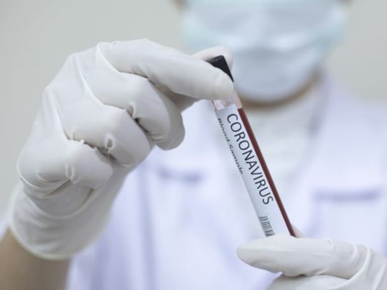 Suspenden funcionamiento de laboratorio en hospital de Temuco por contaminación de test PCR para Covid-19