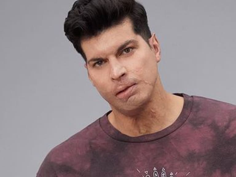 Ignacio Lastra posó con su auto quemado | Instagram