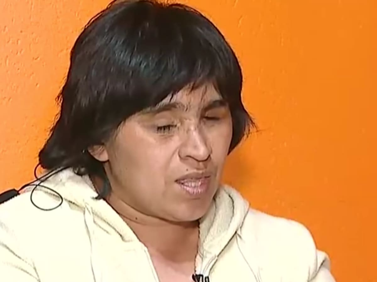 Fabiola Campillai será nuevamente operada este miércoles tras presentar complicaciones en su estado de salud