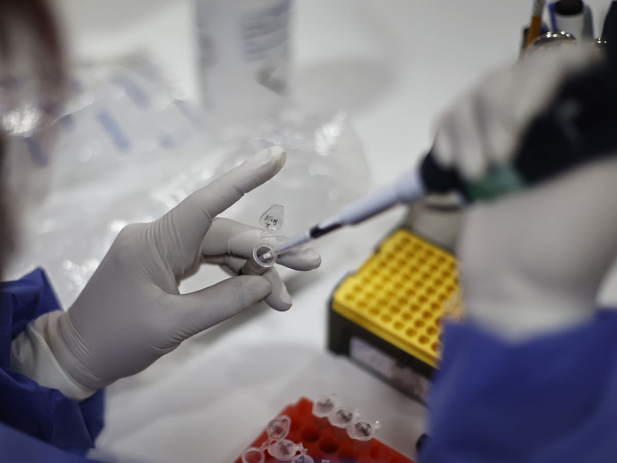 Activan protocolo por posible caso de viruela del mono en Tomé: pruebas son analizadas por el ISP