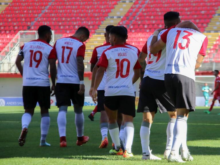Las complicaciones de Curicó Unido para su duelo ante la U