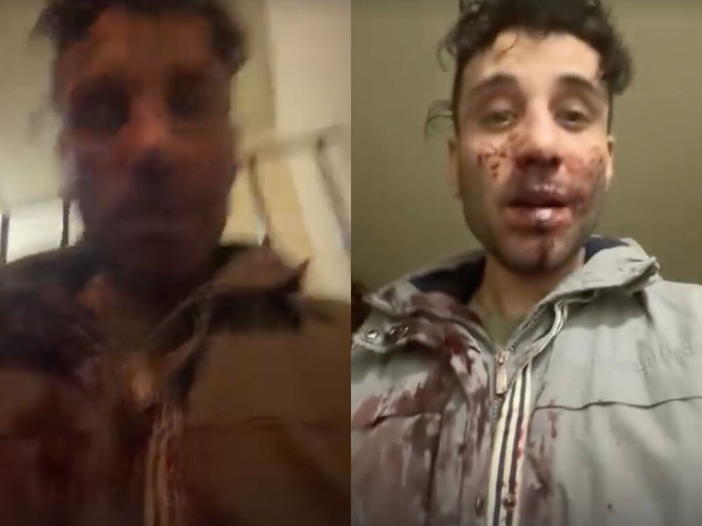 Ganador de reality de Mega publica crudo video tras golpiza: “Así vengo llegando a mi casa”