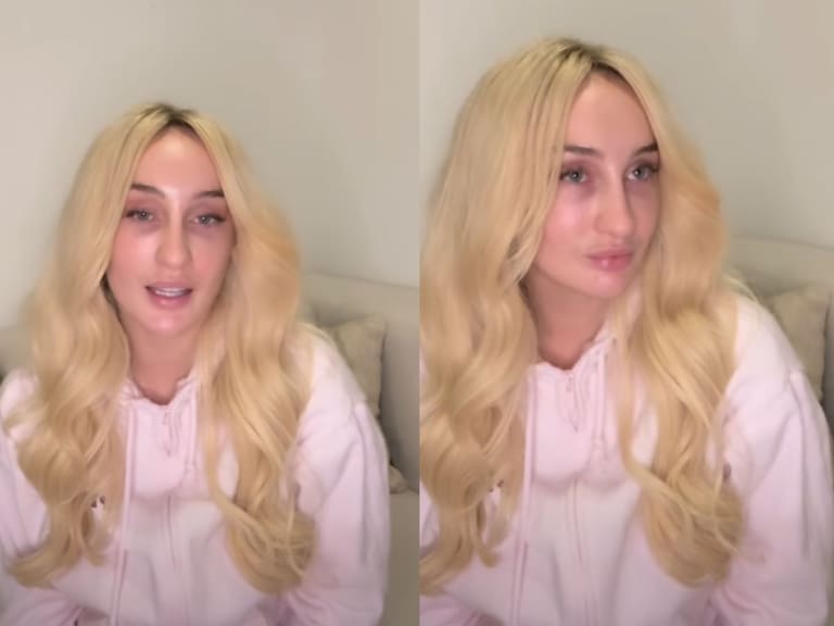 “Caí en un hoyo”: Fran Maira entrega desgarrador testimonio tras protagonizar accidente automovilístico