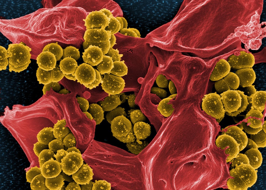 Una bacteria Staphylococcus aureus