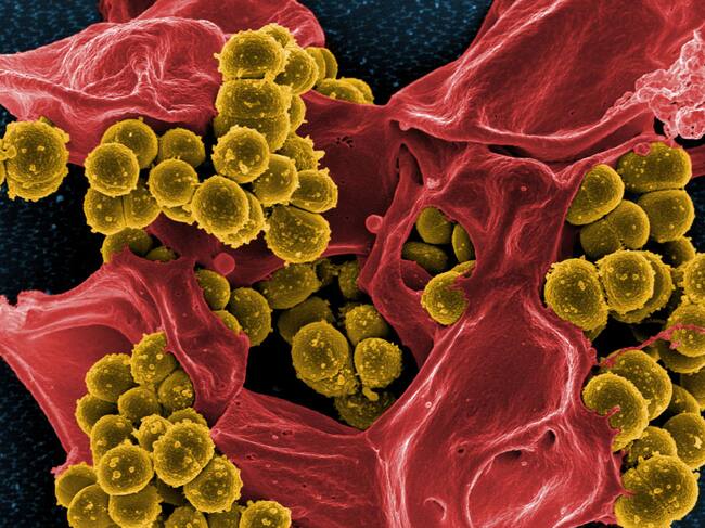 Una bacteria Staphylococcus aureus