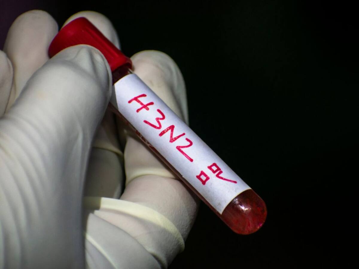 “Era esperado”: Ministerio de Salud confirma primer caso de la influenza H3N2 en Chile