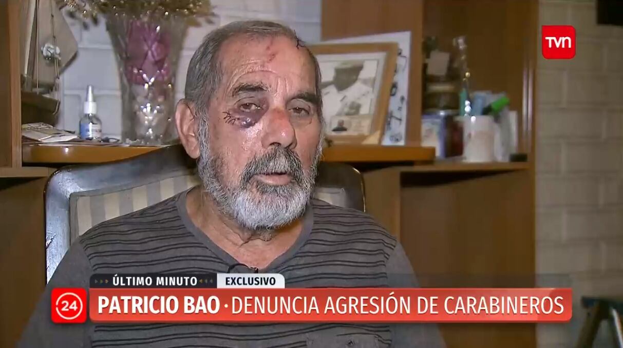 Patricio Bao, agredido por un carabinero