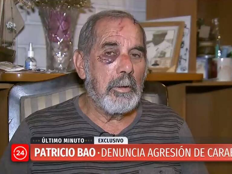 Patricio Bao, agredido por un carabinero