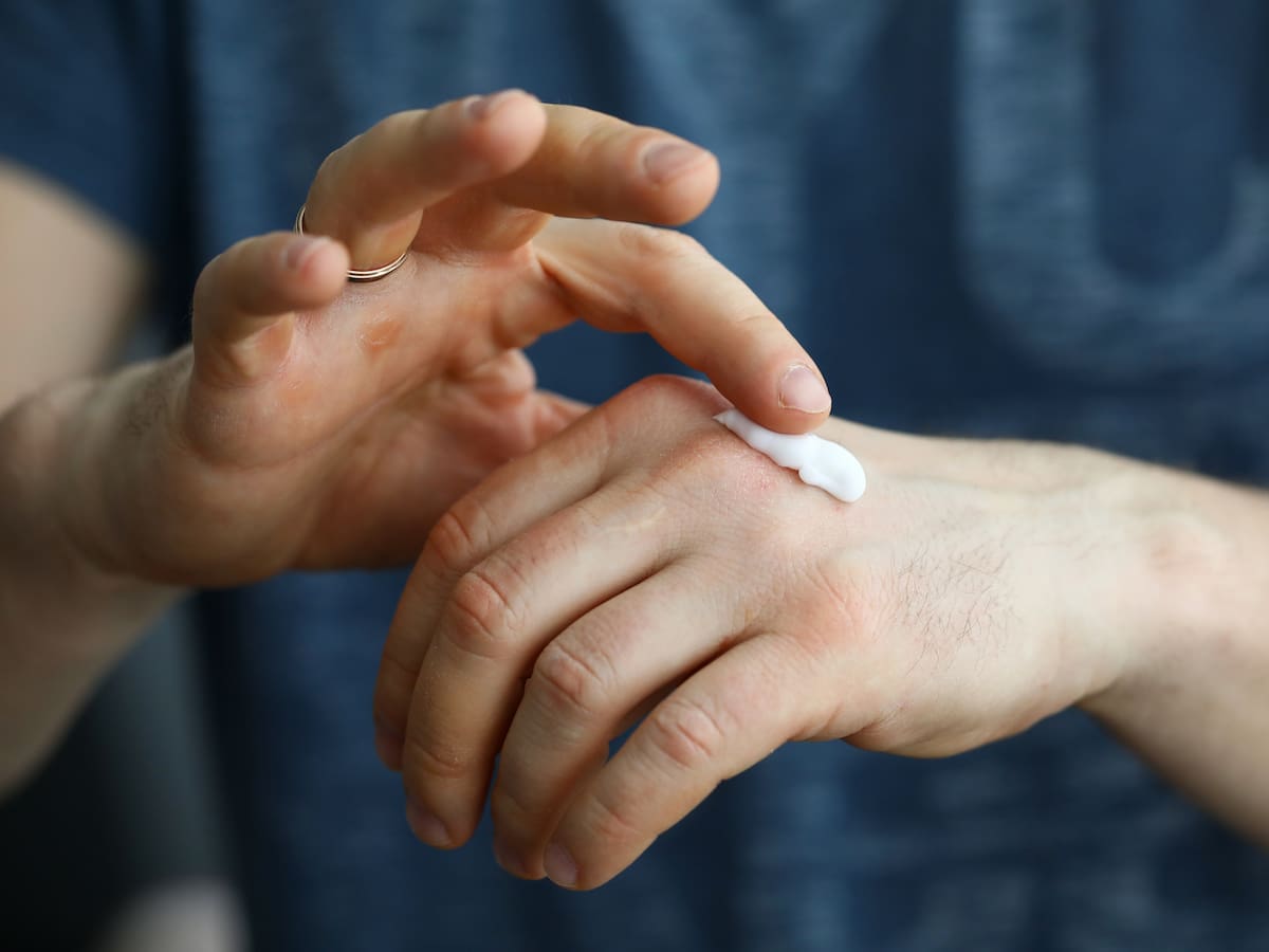 Nuevo tratamiento contra la diabetes: así funciona la crema con insulina que logra regular la glucosa