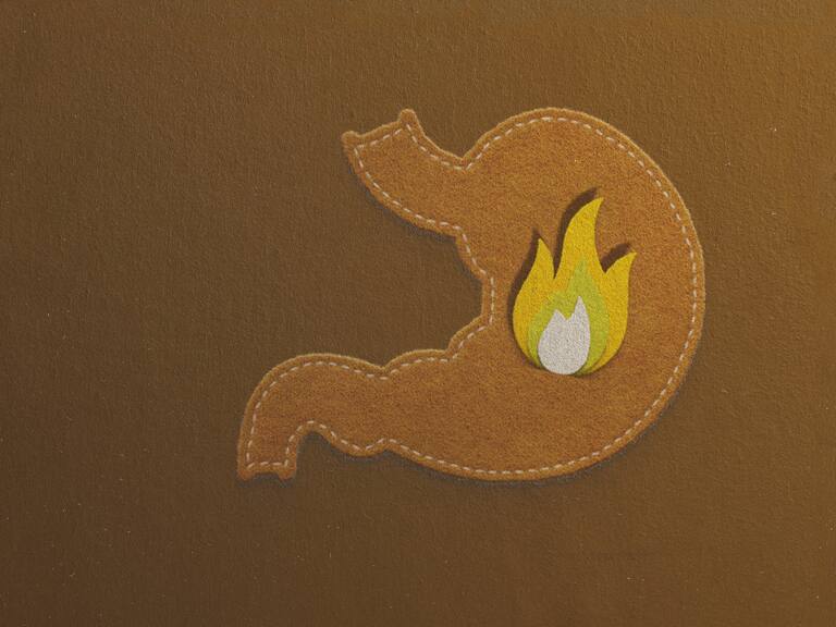 ¿Cuáles son las enfermedades típicas del verano?: El Doctor Chef nos explica