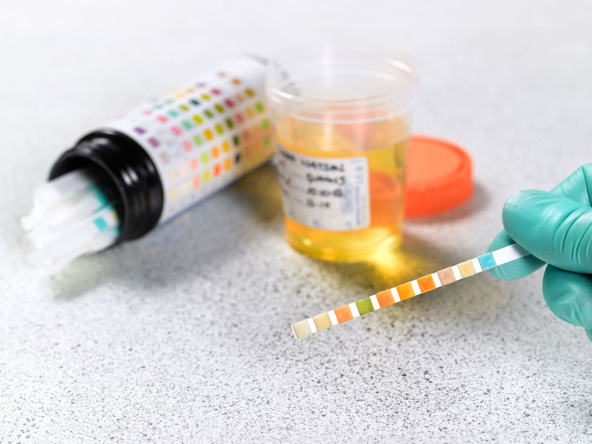Empresas podrían exigir test de drogas antes de firmar contratos: así es el proyecto presentado por la bancada RN