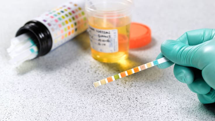Empresas podrían exigir test de drogas antes de firmar contratos: así es el proyecto presentado por la bancada RN