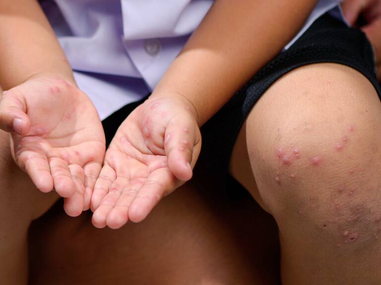 Nueva alerta epidemiológica: lo que hay que saber de la medida anunciada por el gobierno