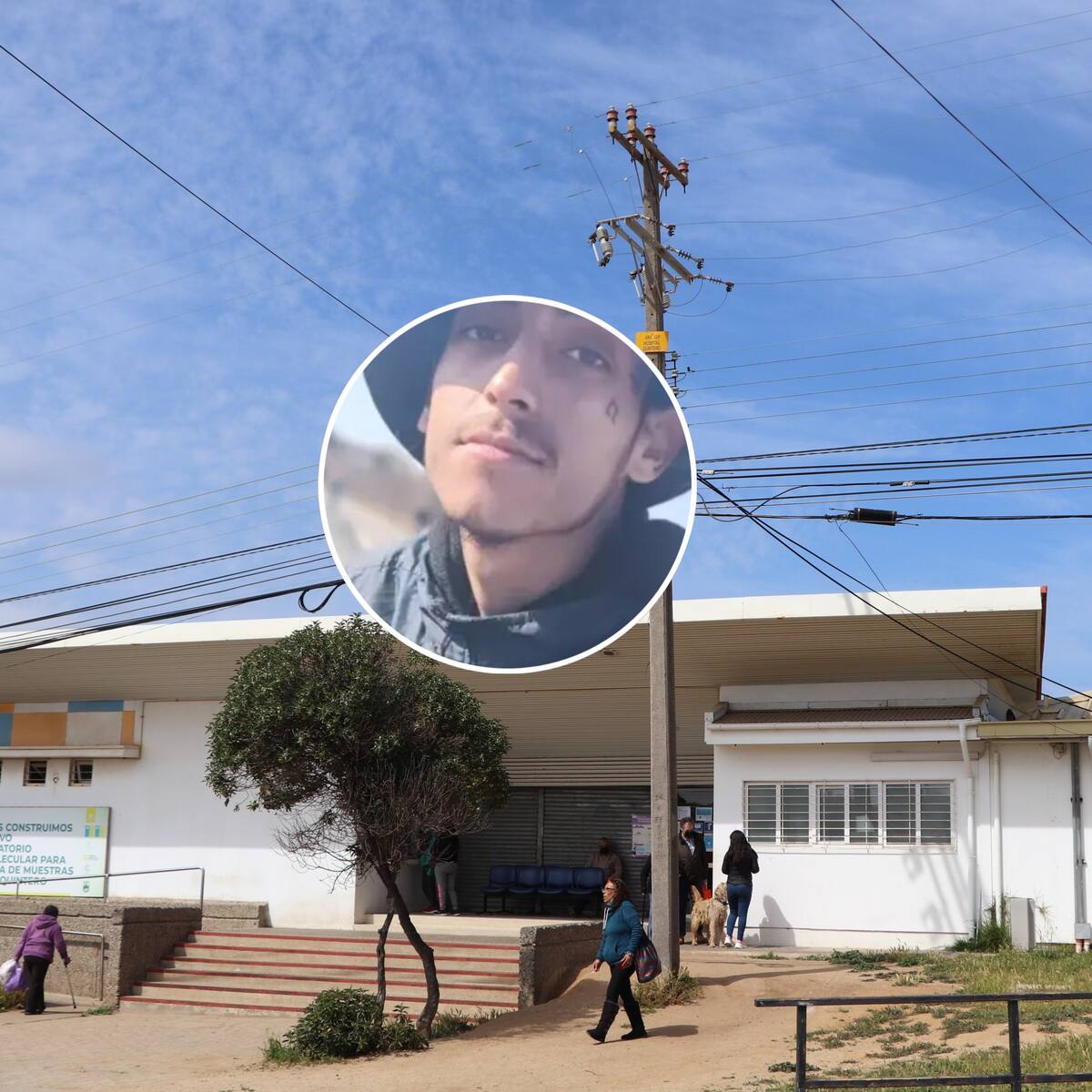 Familia acusa negligencia médica: Fiscalía investiga muerte de joven de 22 años tras acudir tres veces a Urgencias en Quintero