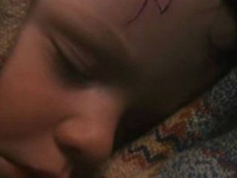 Esta es la verdad sobre la característica cicatriz de Harry Potter