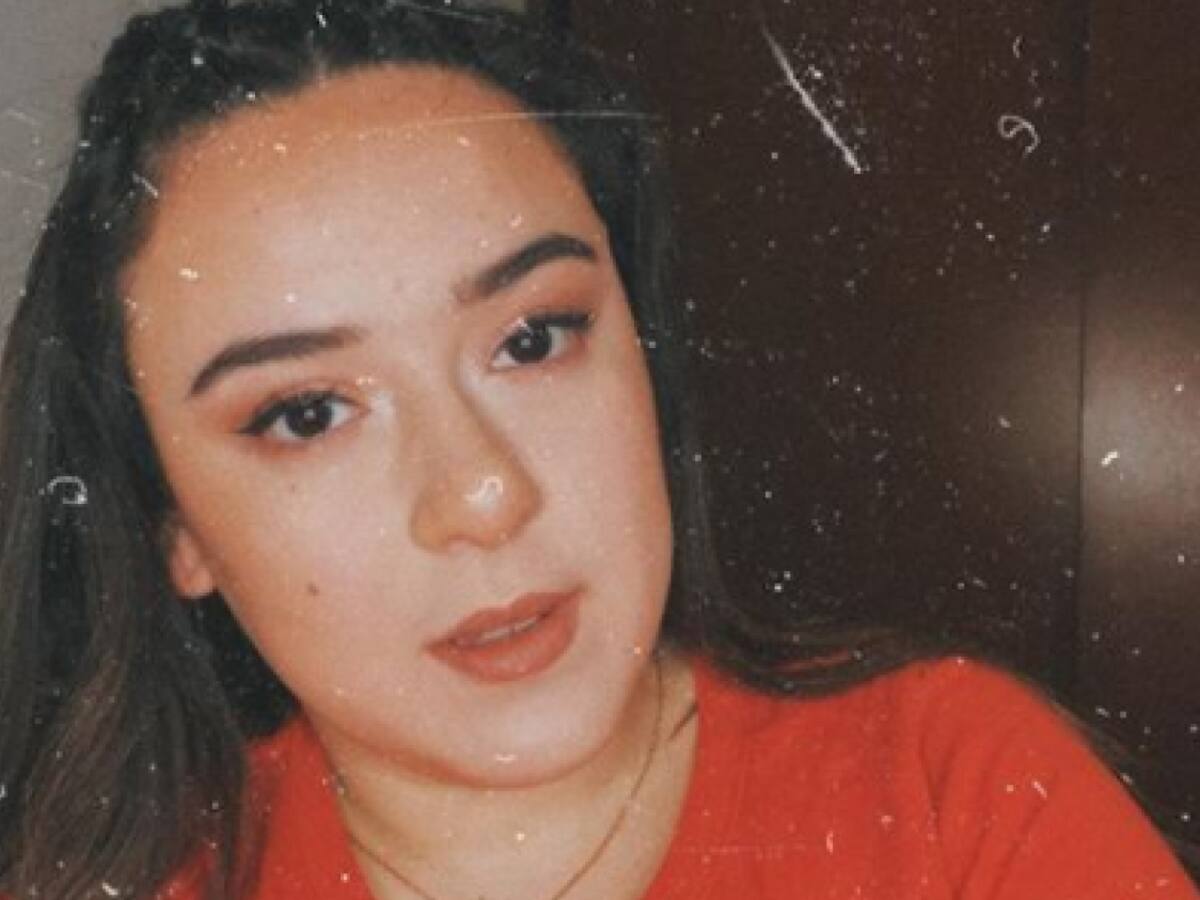 Christell Rodríguez mostró cómo luce su rostros a dos semanas de realizarse una bichectomía