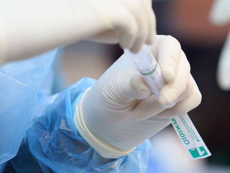 Variante Delta: primer caso en Los Lagos