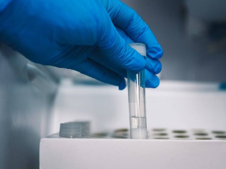 Balance covid del 2 de agosto: cerca de cinco mil casos nuevos y siete fallecidos