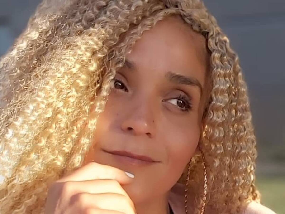 «No tenía nada»: Katherine Orellana mostró el resultado de intervención estética en los labios