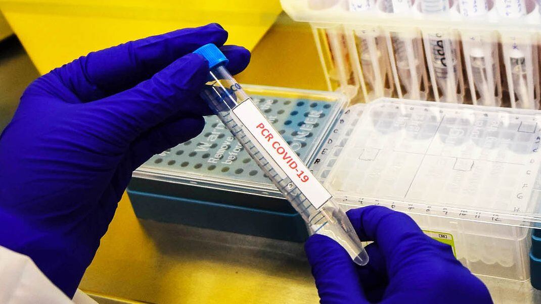 PCR
