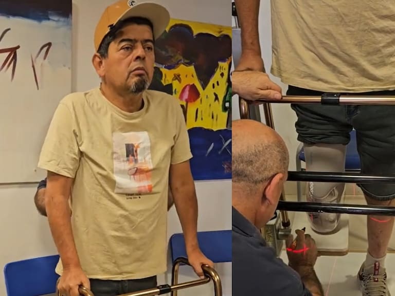 Mostró su nueva prótesis: Mauricio Medina expone cómo ha sido el difícil proceso de su rehabilitación tras la amputación de la mitad de su pierna