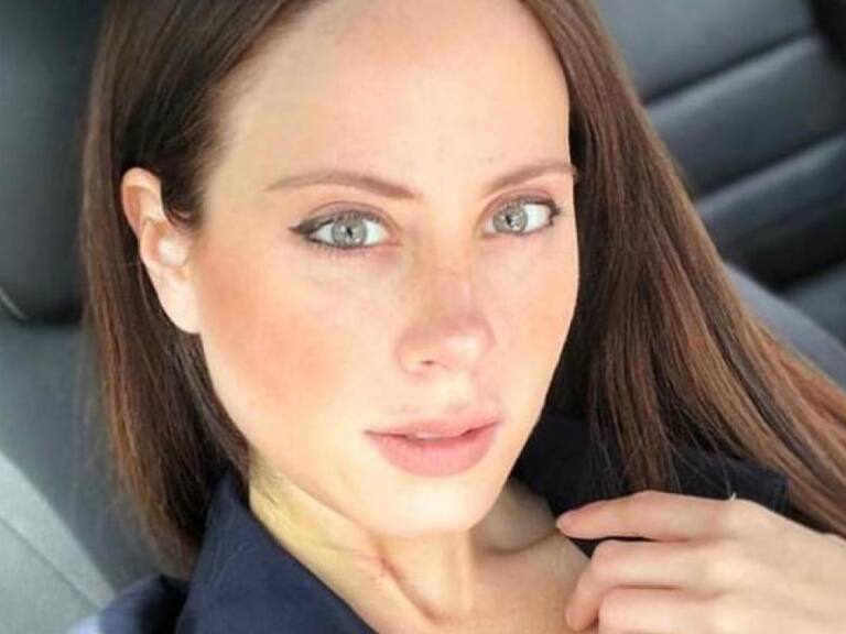 «Operación mal hecha»: Nacha Michelson es duramente criticada por reciente foto en Instagram