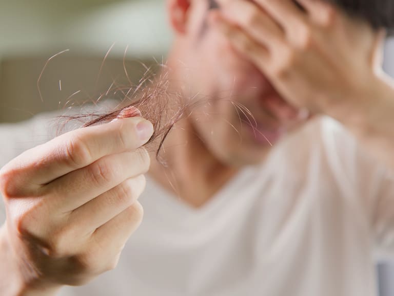 El estrés de hoy podría hacer que se te caiga el pelo meses después: por qué ocurre y cuándo preocuparse