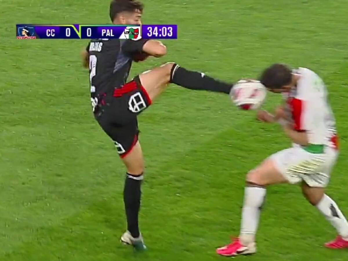 Fernando Meza muestra la gran herida que quedó en su rostro tras patada de Jeyson Rojas en el Colo Colo-Palestino
