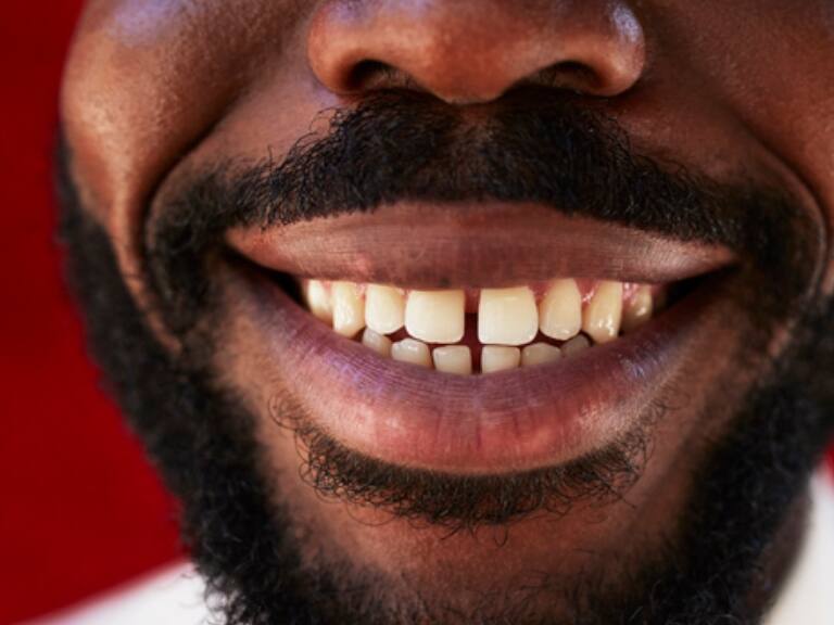 Investigadores crean medicamento que podría regenerar los dientes