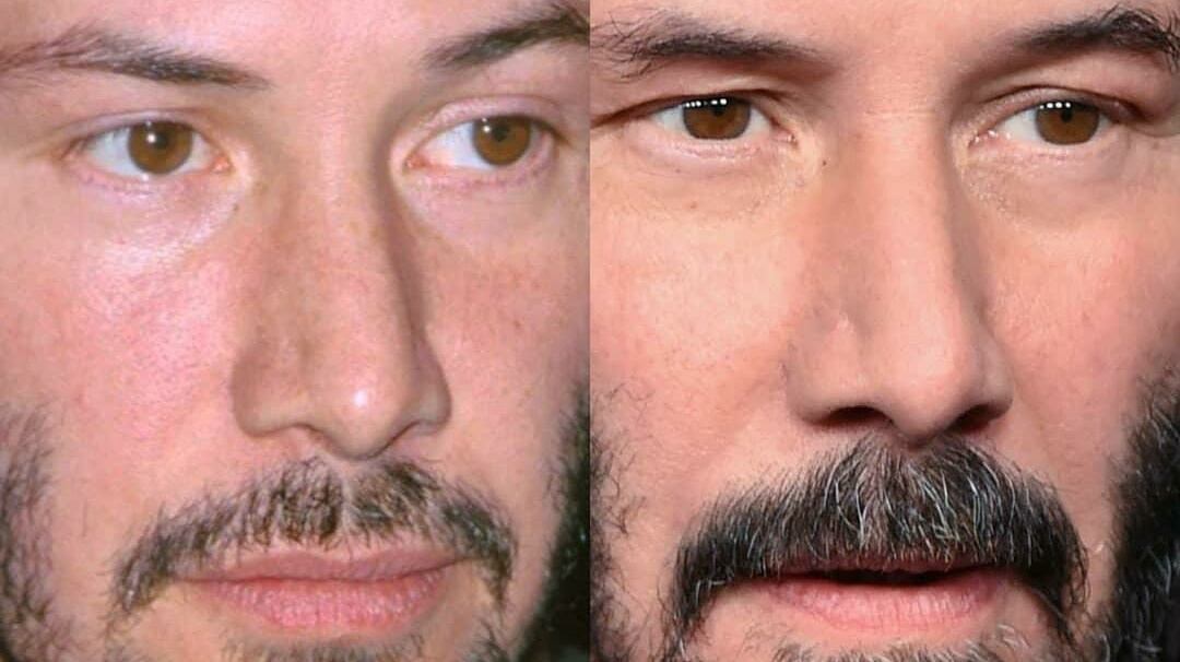Instagram @celebbeforeafter