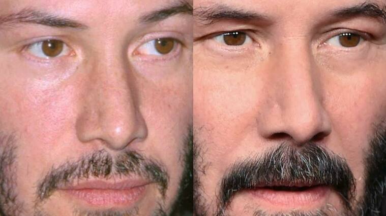 Instagram @celebbeforeafter