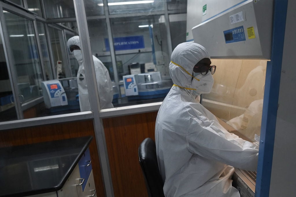 Tecnólogos analizan muestras de la viruela del mono en Chennai en India