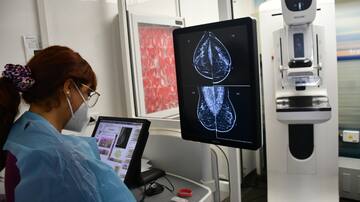 Estudio predice que los casos de cáncer de próstata se duplicarán en 20 años: científicos explican la razón