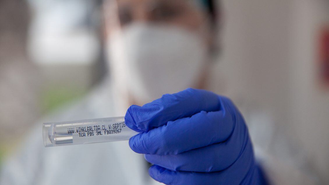 07 de Enero de 2022/SANTIAGO
Operativo exámenes PCR para la detección del Virus Covid-19 y trazabilidad. Ministerio de Salud informa 3.799 casos nuevos de COVID-19, con una positividad de 4,75% en las últimas 24 horas a nivel nacional, con 74.482 exámenes, PCR y test de antígeno.
FOTO BASTIÁN CIFUENTES /AGENCIAUNO