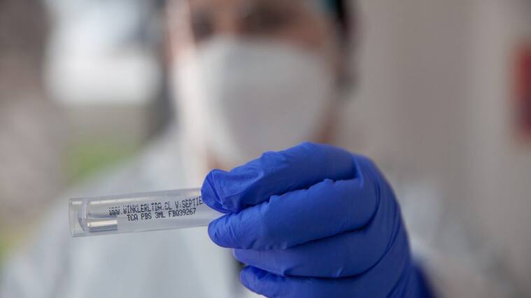 07 de Enero de 2022/SANTIAGO
Operativo exámenes PCR para la detección del Virus Covid-19 y trazabilidad. Ministerio de Salud informa 3.799 casos nuevos de COVID-19, con una positividad de 4,75% en las últimas 24 horas a nivel nacional, con 74.482 exámenes, PCR y test de antígeno.
FOTO BASTIÁN CIFUENTES /AGENCIAUNO