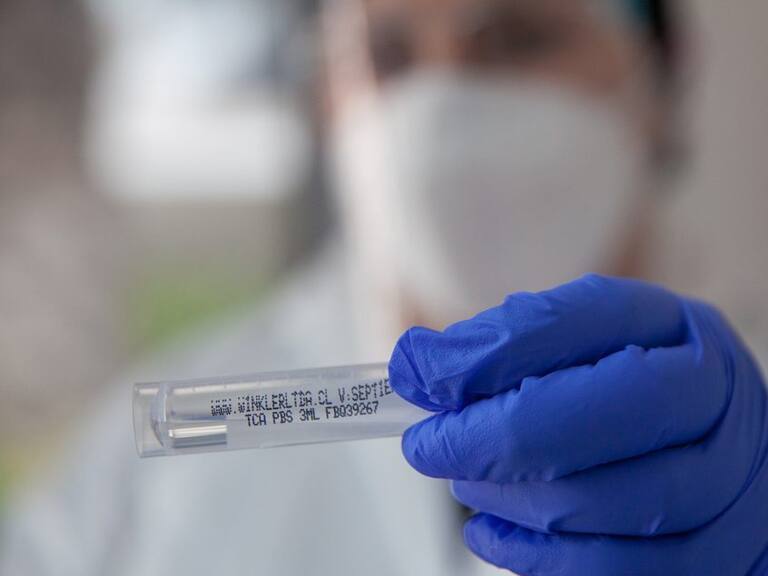 07 de Enero de 2022/SANTIAGO
Operativo exámenes PCR para la detección del Virus Covid-19 y trazabilidad. Ministerio de Salud informa 3.799 casos nuevos de COVID-19, con una positividad de 4,75% en las últimas 24 horas a nivel nacional, con 74.482 exámenes, PCR y test de antígeno.
FOTO BASTIÁN CIFUENTES /AGENCIAUNO