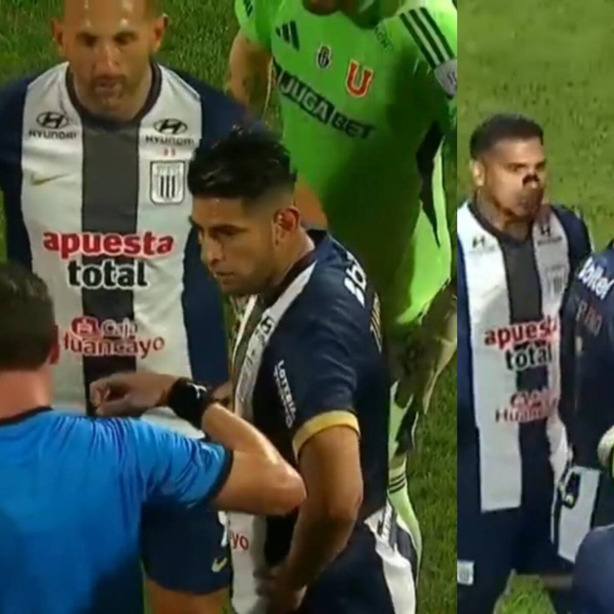 Cometió una falta similar ante la U: defensa de Alianza Lima no aprende y otra vez es expulsado en Perú