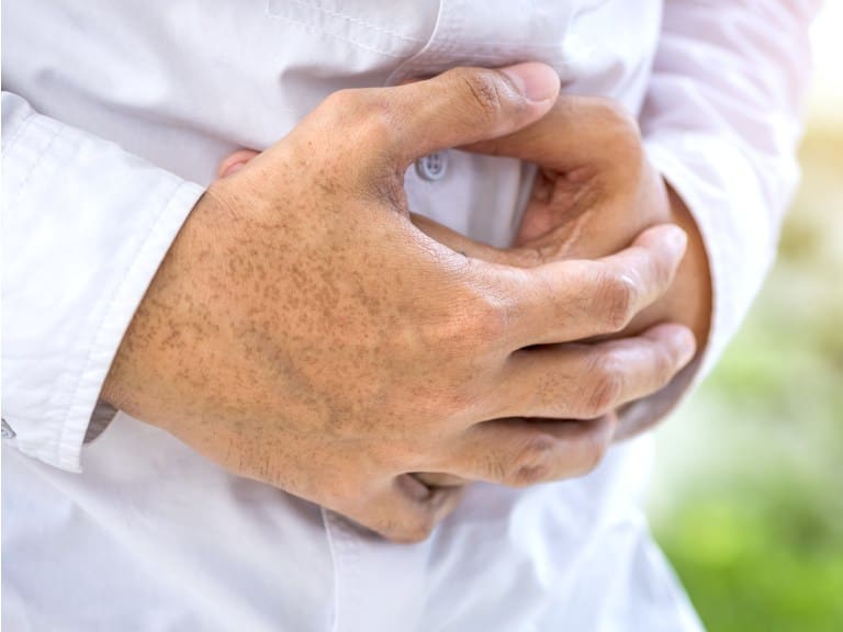 Día Mundial del Cáncer de Colon: cómo prevenirlo y síntomas a considerar