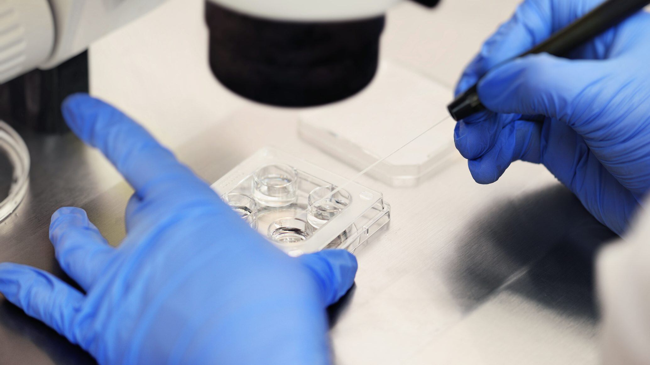 The process of artificial insemination of an egg in an IVF clinic. Reproductive medicine, in vitro fertilization