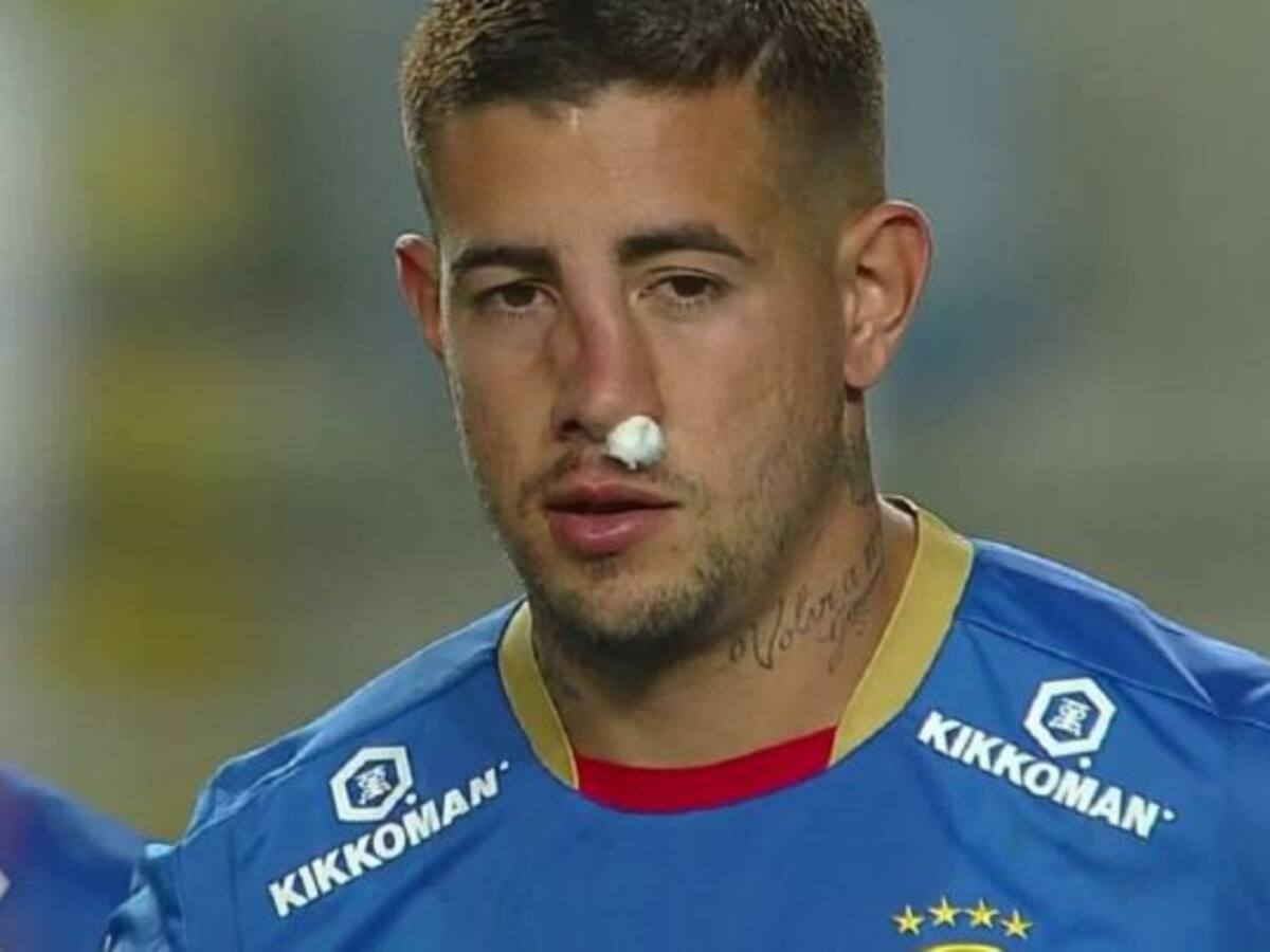Rodrigo Holgado fue operado con éxito y estaría disponible para jugar el sábado ante Unión Española